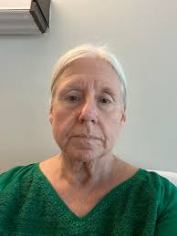 Hi all, My name is Steve, I live in Somerset in the UK. Had my surgery at  the end of May, been fitted with my prostestic for about 5 weeks now and