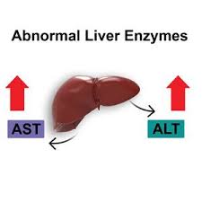 Image result for Liver Function Test Abnormality