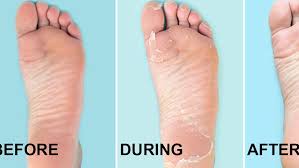 Look for moisturizers that are free of. Baby Foot Review 5 Women Tried It And The Results Were Both Disgusting And Satisfying Glamour