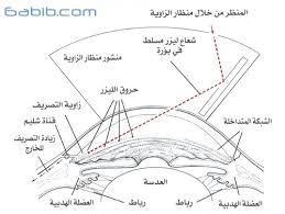 مؤسسة إبصار الصحية الجلوكوما الغلوكوما المياه الزرقاء الزرق الماء الاسود في العين اللص الصامت