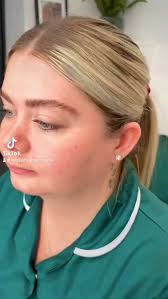 ✨ Chin & Pre-Jowl Perfection ✨, 2ml of dermal filler using a cannula to  sculpt the chin and soften pre-jowls for a smoother, more defined profile  💉💕, #DermalFiller #ChinFiller #PreJowlFiller ...