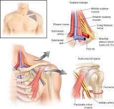 Chest Wall Pleural Space Diaphragm Thoracic Outlet Syndrome Supraclavicular Thoracic Outlet Decompression Thoracic Key