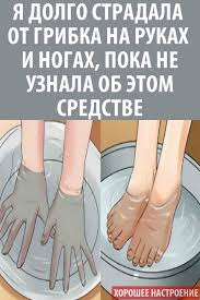 как вылечить грибок на ногах в домашних условиях видео Ya Dolgo Stradala Ot Gribka Na Rukah I Nogah Poka Ne Uznala Ob Etom Sredstve Daily Health Tips Health Health Tips