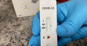 In che cosa si differenzia rispetto al tampone molecolare? Esclarecimento Sobre Testes Rapidos Para Covid 19 Em Farmacias Pfarma