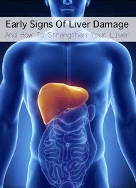 Early Signs Of Liver Damage How To Strengthen Your Liver Http Improvedaging Com Early Signs Of Liver Damage How Liver Health Liver Detox Symptoms Health