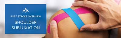 Image result for Shoulder Subluxation