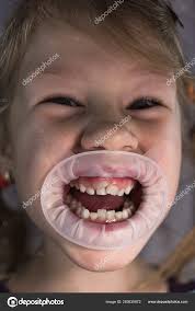 Adult Permanent Teeth Coming In Front Of The Child S Baby Teeth Stock Photo By C Alex862 Yandex Ru 283835872
