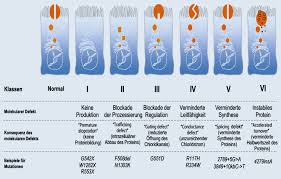 Cystic fibrosis foundation, about cystic fibrosis. Zystische Fibrose Mukoviszidose Im Kindes Und Jugendalter Springerlink