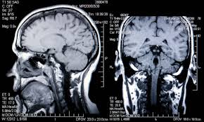 Anxiety too doesn't rely on stress to appear, it's more complex than that. Brain Scanning Medicine Britannica