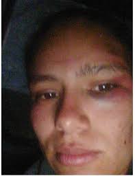 Denunciometro Tláhuac