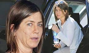 The laser vaporizes skin cells one layer at a time, and the recovery time is 1 to 2 weeks. Jennifer Aniston Films Cake With Sam Worthington And Anna Kendrick Daily Mail Online