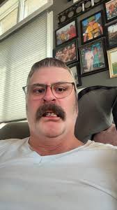 Error code in Dish Scape gallery?