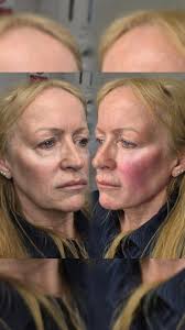 We all love a liquid lunch break 👀 , When you excuse yourself from work  for a "Doctors Appointment" and pull up at your work desk, looking 10 years  younger 🤫 , No injection entry point to be seen 🤣 , ...