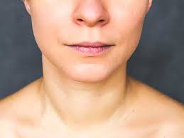 Oct 27, 2017 · a 2010 study suggested that people who did neck exercises decreased headache and neck pain. Receding Chin Pictures Causes Exercises And Surgery