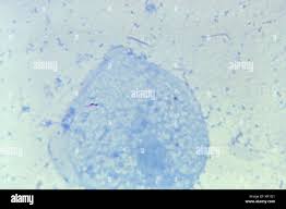 Detection & Molecular Identification Of Mycobacteria