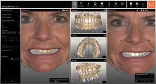 PRIME MULTISTRATUM®