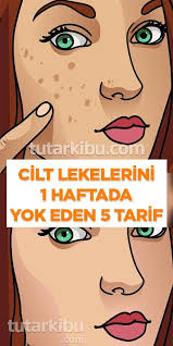 Yuzdeki Lekeleri 1 Haftada Yok Eden Tarifler Cilt Tedavileri Yuzler Dogal Guzellik Ipuclari