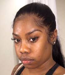 Hdlace wigs and large amounts of wholesale lace frontals and affordable it's typically 13 long and 4 wide. Frontal Queen Porscha Weeks Bald Head Photos Start Debate About Black Hair Allure