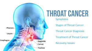 Can anxiety mimic symptoms of cancers? Hpv Mouth And Throat Cancer InÈ›elesul Papillomavirus In DicÈ›ionarul EnglezÄƒ