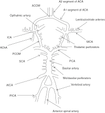 Ischemic stroke is the most common of the three types of stroke. Stroke Chapter 21 Neurology