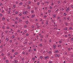 We are pleased to announce a new free case based urology learning program from the cleveland clinic glickman urological and kidney institute, rainbow babies and children's hospital, and university hospitals case medical center. Liver And Gallbladder Histology