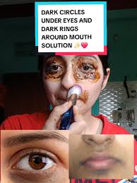 Mk Royalthread Dark Circle Video