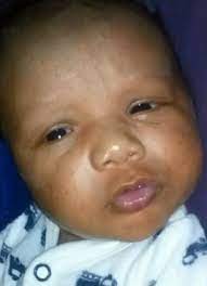 Mother Of Baby Whose Nose Was Bitten Off By Father Speaks Out Daily Mail Online