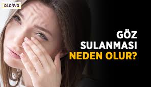Goz Sulanmasi Neden Olur