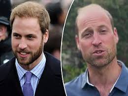 Prince William is named world's sexiest bald man for the second year in a  row