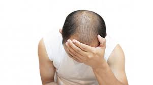 Kandhari clinic in vasant vihar & greater kailash in south delhi. 5 Best Affordable Hair Loss Treatment Clinics In Delhi India