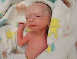 A Weekly Look At Premature Babies And Complications Premature Baby 30 Weeks Pregnant Baby Preterm Baby