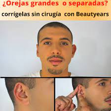 Beautyears Corrector De Orejas Beautyears Una Solucion Facebook