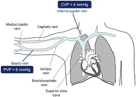 Cvp analysis also manages product contribution margin. A Novel Non Invasive Device For The Assessment Of Cvp Mder