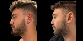 Cory S. Goldberg, BSc, MD, FRCS(C), Certified Plastic Surgeon