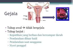 Maybe you would like to learn more about one of these? Deteksi Dini Kanker Leher Rahim Iva Tes Ppt Download
