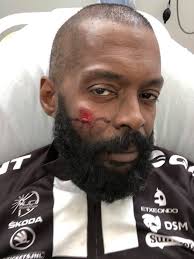 Support for injured biker after crash