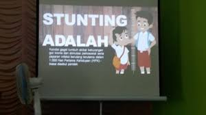 Stunting adalah kondisi gagal tumbuh pada anak di bawah dua tahun yang disebabkan oleh masalah gizi kronis. Work Shop Penanganan Stunting Kec Bunguran Timur Kab Natuna