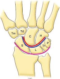 Normal Anatomy Of The Carpal Bones Diagram Of The Wrist