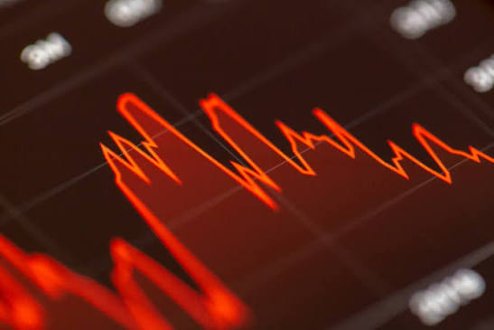 Stock market panic reveals underlying crisis