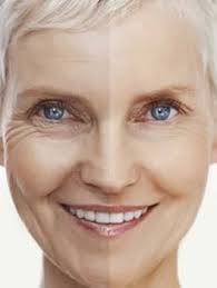 دي ان اي كود سكين كير بديل كود بدون ابرة