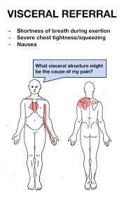 Visceral Pain Referral Snapspt