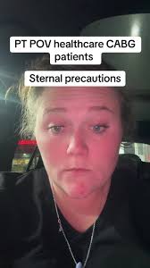 Humorous PT Encounter with CABG Patients