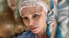 Christie Brinkley Shares Photos Of Skin Cancer Procedure, Touts ...