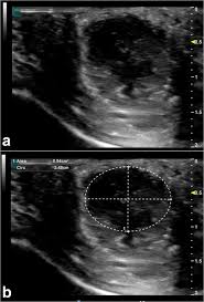 Camel art foundation is organizing an online national level contest inviting participation from students and professionals above 18 years. Ultrasound Detection Of Cosmic Filler Injection Of Lips In Camel Beauty Pageants First Report In Veterinary Medicine Springerlink