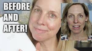 Before And After Revive Light Therapy Results Youtube