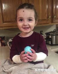 美国3岁女孩患怪病，稍微碰一下就脱皮，母亲不能靠近她！_治疗