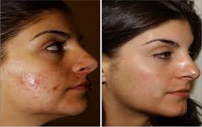 Angeline — VILLANI MEDICAL