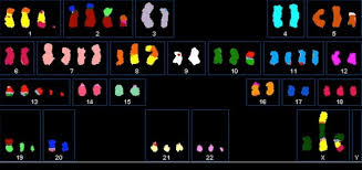 Bowel cancer, also known as colorectal cancer, usually affects the large intestine. A Step Toward A Universal Cancer Blood Test Wired