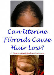 Biotin Pills For Hair Growth Side Effects Seizure Medicine Hair Loss Cortisone Shots In Head For Hair Loss Dianabol Side Effects Hair Loss Can You Hair Loss Regrowth Hair Loss Women Oil For Hair Loss