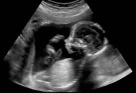 In meaning islam name zameer. Calcification Ageing Of Placenta During Pregnancy